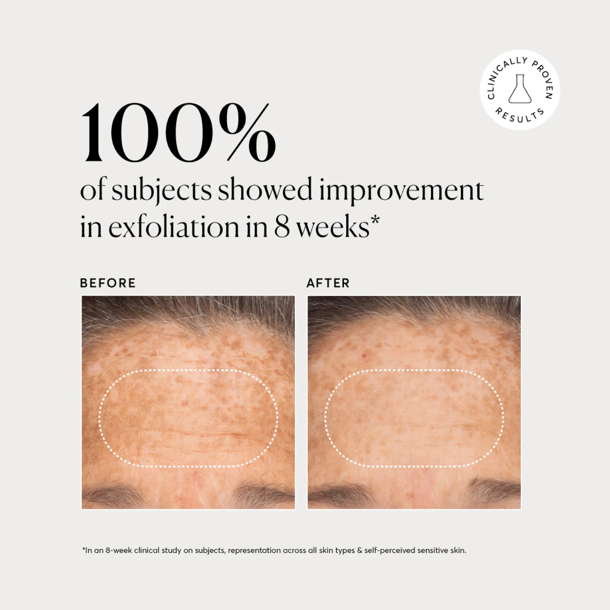 bha-liquid-exfoliant-2-k6 NATR-10027-Alt-Images-BHA-Liquid-Exfoliant-2_-03.webp